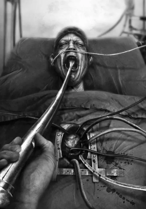 image looking from Tony Valdez"s hand down the applicator into the patient"s mouth. There are tubes coming from a hole in the patient"s chest